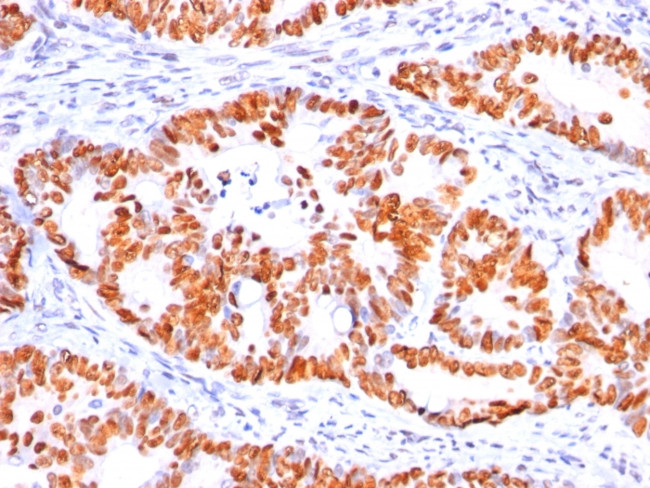 p53 Tumor Suppressor Protein Antibody in Immunohistochemistry (Paraffin) (IHC (P))