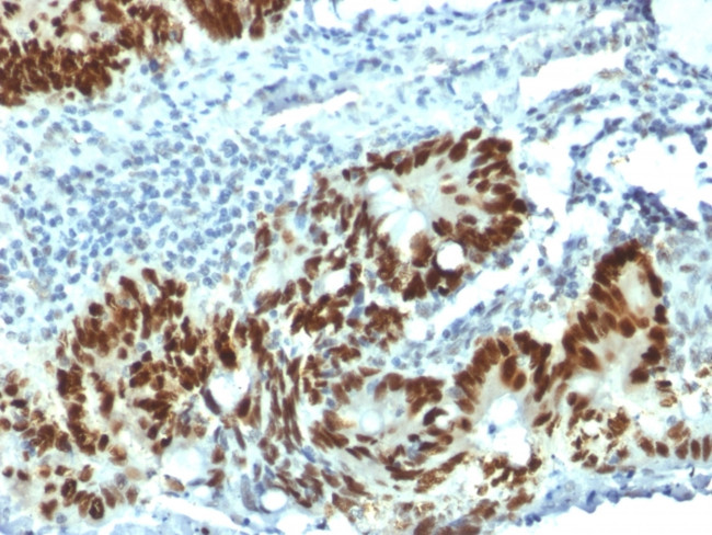 p53 Tumor Suppressor Protein Antibody in Immunohistochemistry (Paraffin) (IHC (P))