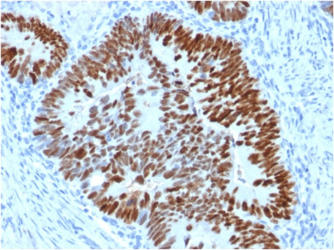 p53 (Tumor Suppressor Protein Antibody in Immunohistochemistry (Paraffin) (IHC (P))