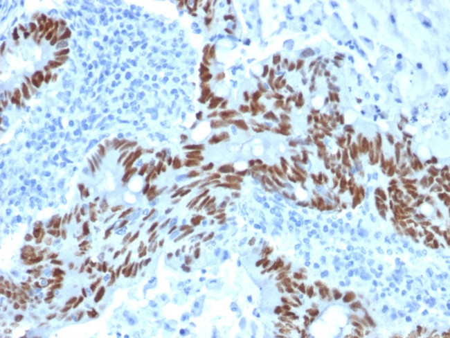 p53 (Tumor Suppressor Protein) Antibody in Immunohistochemistry (Paraffin) (IHC (P))