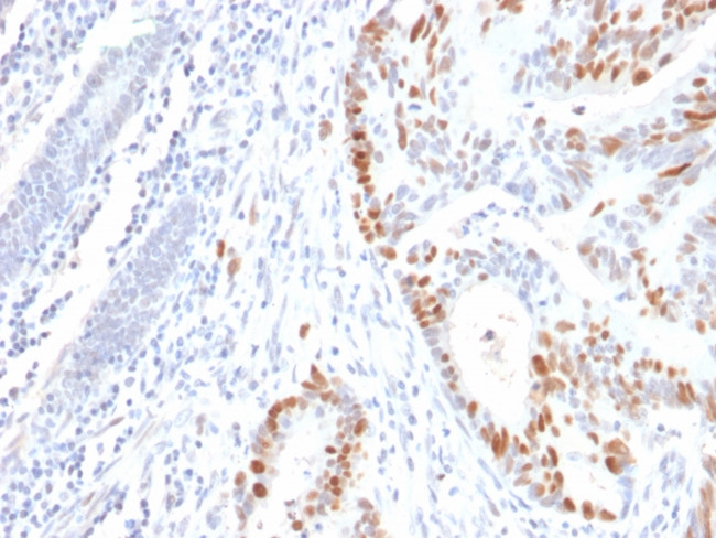 p53 Tumor Suppressor Protein Antibody in Immunohistochemistry (Paraffin) (IHC (P))