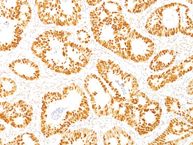 p53 Tumor Suppressor Protein Antibody in Immunohistochemistry (Paraffin) (IHC (P))