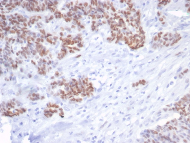 p53 Tumor Suppressor Protein Antibody in Immunohistochemistry (Paraffin) (IHC (P))