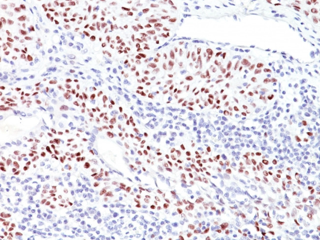 p53 Tumor Suppressor Protein Antibody in Immunohistochemistry (Paraffin) (IHC (P))