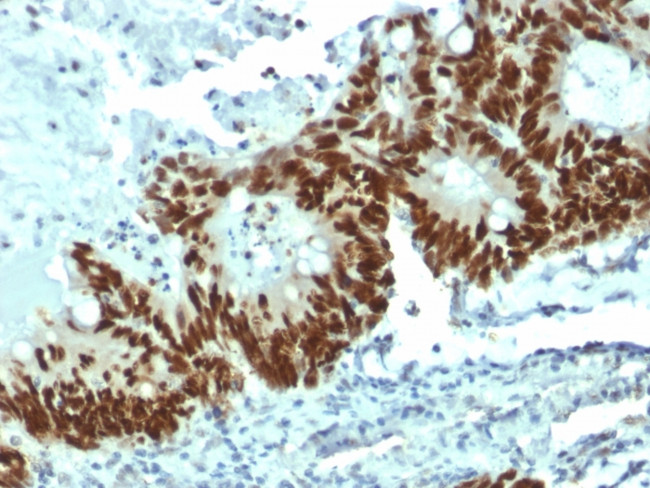 p53 Tumor Suppressor Protein Antibody in Immunohistochemistry (Paraffin) (IHC (P))