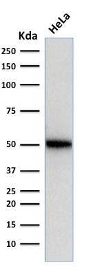 p53 Tumor Suppressor Protein Antibody in Western Blot (WB)