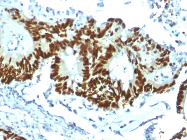 p53 Tumor Suppressor Protein Antibody in Immunohistochemistry (Paraffin) (IHC (P))