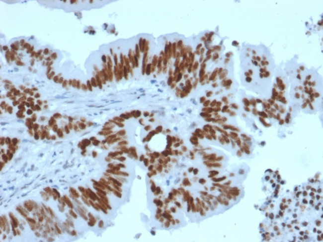 p53 Tumor Suppressor Protein Antibody in Immunohistochemistry (Paraffin) (IHC (P))