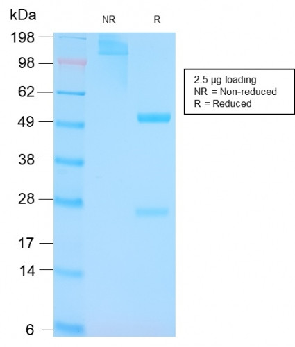 p53 Tumor Suppressor Protein Antibody in SDS-PAGE (SDS-PAGE)