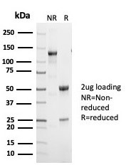 p53 (Tumor Suppressor Protein) Antibody in SDS-PAGE (SDS-PAGE)