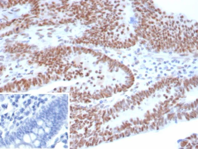 p53 (Tumor Suppressor Protein) Antibody in Immunohistochemistry (Paraffin) (IHC (P))