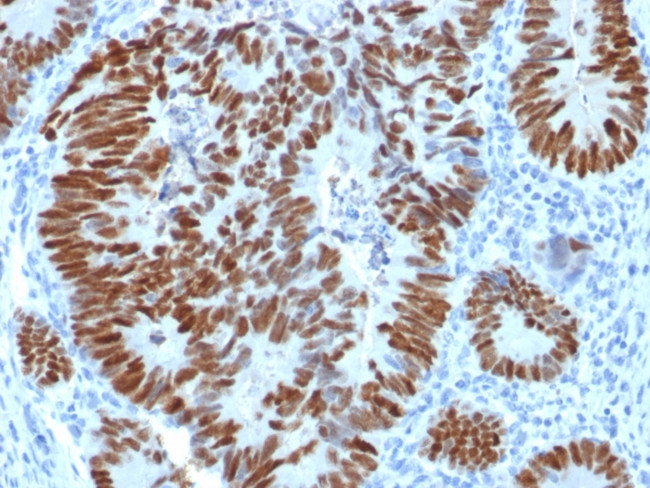p53 Tumor Suppressor Protein Antibody in Immunohistochemistry (Paraffin) (IHC (P))