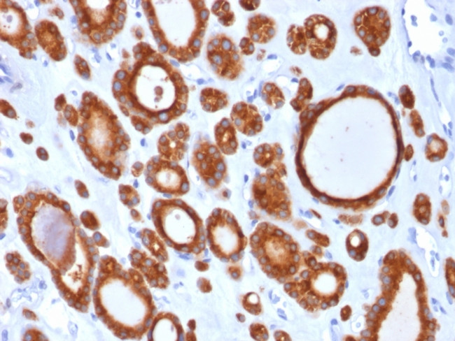 TPO (Thyroid Peroxidase) (Thyroid Marker) Antibody in Immunohistochemistry (Paraffin) (IHC (P))