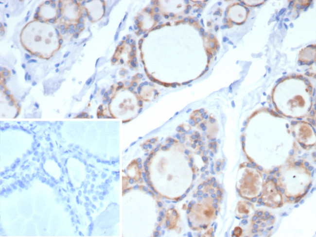 TPO (Thyroid Peroxidase) (Thyroid Marker) Antibody in Immunohistochemistry (Paraffin) (IHC (P))