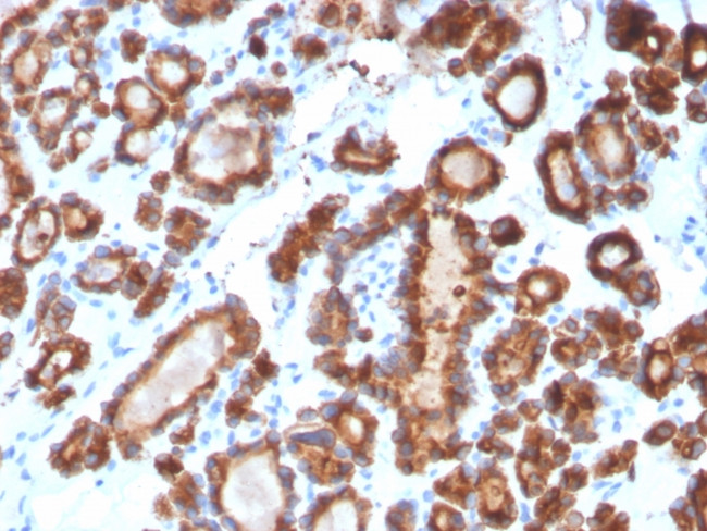 TPO (Thyroid Peroxidase) (Thyroid Marker) Antibody in Immunohistochemistry (Paraffin) (IHC (P))