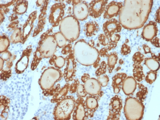 TPO (Thyroid Peroxidase) (Thyroid Marker) Antibody in Immunohistochemistry (Paraffin) (IHC (P))