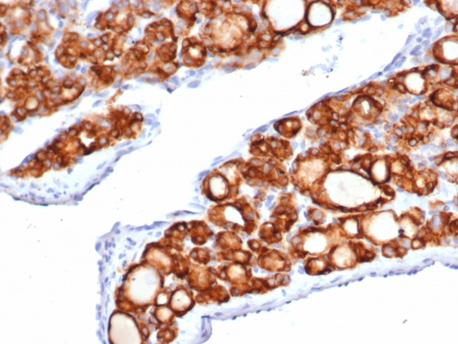 TPO (Thyroid Peroxidase) (Thyroid Marker) Antibody in Immunohistochemistry (Paraffin) (IHC (P))