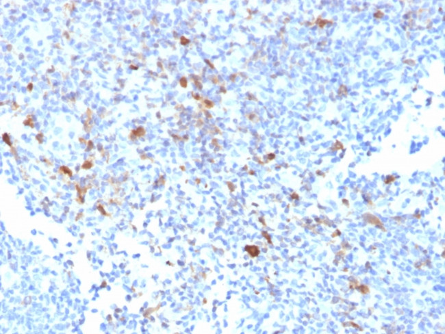 TRAF1 (TNFR-Associated Factor 1) Antibody in Immunohistochemistry (Paraffin) (IHC (P))