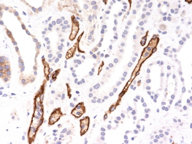 Complement 4d (C4d) (Acute Humoral Rejection Marker) Antibody in Immunohistochemistry (Paraffin) (IHC (P))