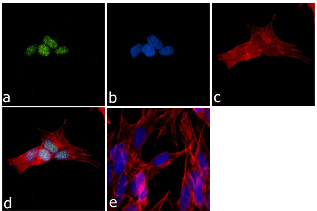 GLIS1 Antibody in Immunocytochemistry (ICC/IF)