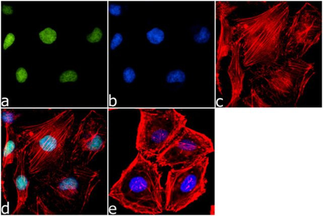 Btk Antibody in Immunocytochemistry (ICC/IF)