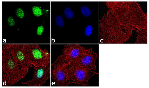 ATAD2 Antibody in Immunocytochemistry (ICC/IF)