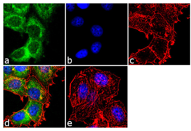 PRMT1 Antibody in Immunocytochemistry (ICC/IF)