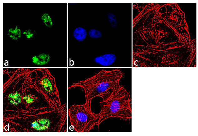SOX21 Antibody in Immunocytochemistry (ICC/IF)