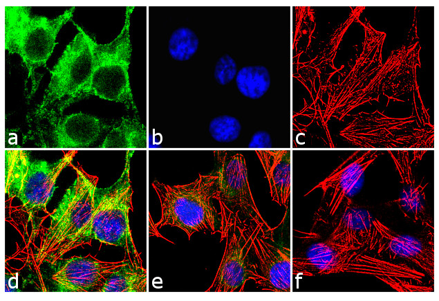 Plexin A2 Antibody in Immunocytochemistry (ICC/IF)