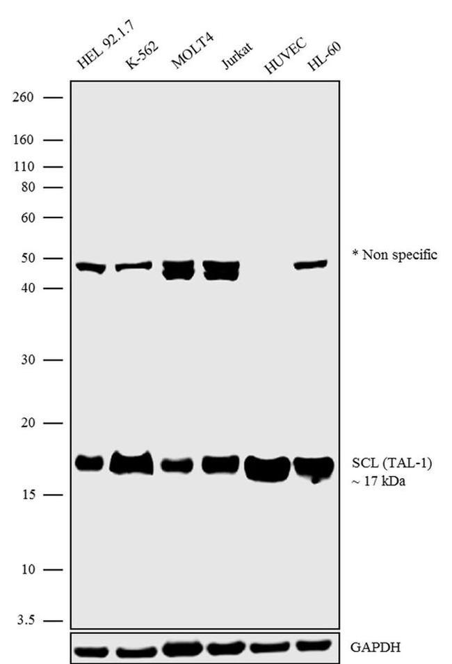 TAL1 Antibody in Western Blot (WB)