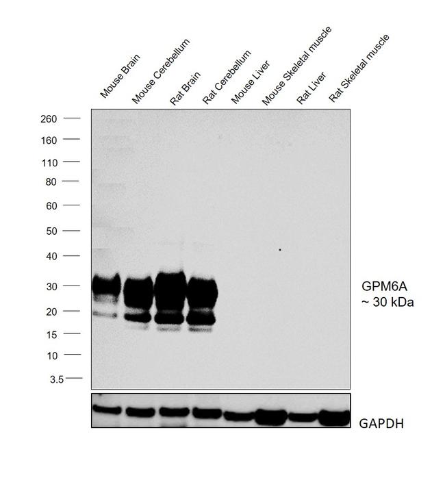 GPM6A Antibody in Western Blot (WB)