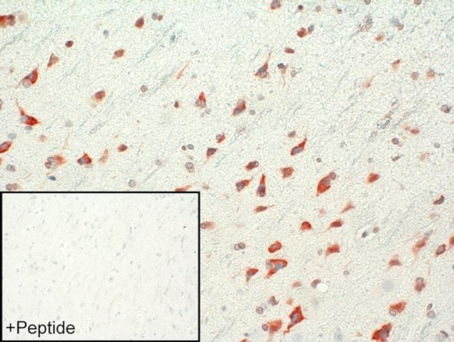 mGluR1 Antibody in Immunohistochemistry (IHC)