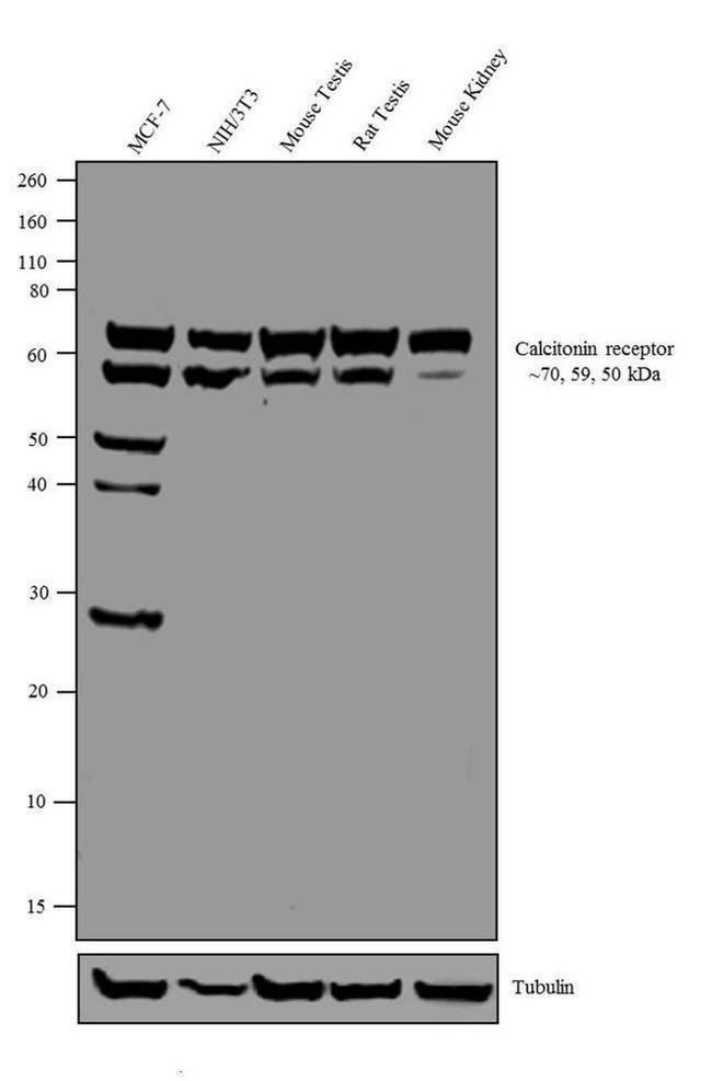 Calcitonin Receptor Antibody in Western Blot (WB)