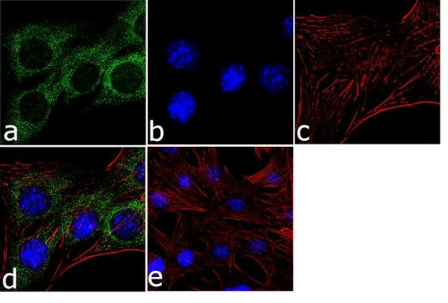 TPM3 Antibody in Immunocytochemistry (ICC/IF)