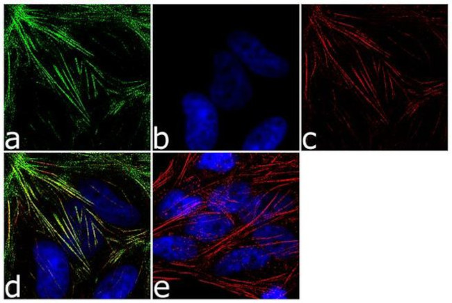TPM4 Antibody in Immunocytochemistry (ICC/IF)