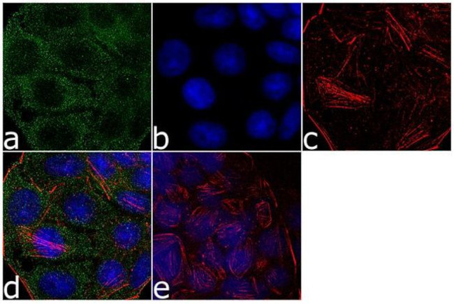 TFF3 Antibody in Immunocytochemistry (ICC/IF)