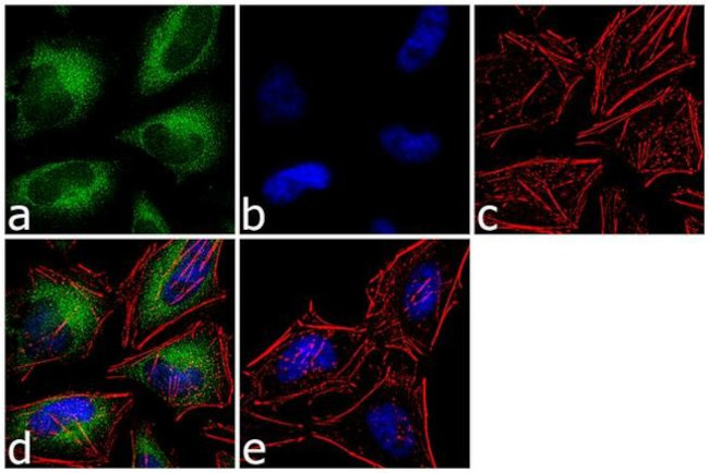 Calcyclin Antibody in Immunocytochemistry (ICC/IF)