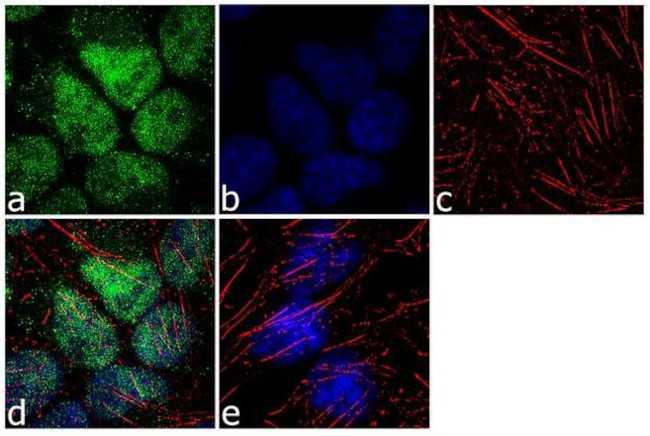 SMAD9 Antibody in Immunocytochemistry (ICC/IF)