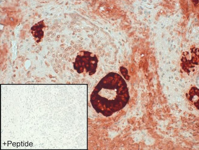 BDKRB2 Antibody in Immunohistochemistry (IHC)