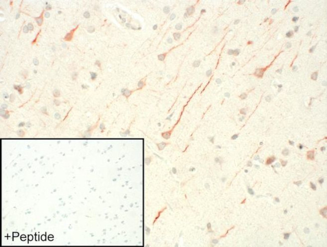 FPR1 Antibody in Immunohistochemistry (IHC)