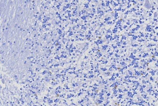 TRPS1 (Transcriptional repressor GATA binding 1) Antibody in Immunohistochemistry (Paraffin) (IHC (P))