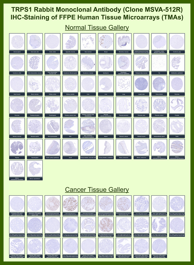 TRPS1 (Transcriptional repressor GATA binding 1) Antibody in Immunohistochemistry (Paraffin) (IHC (P))