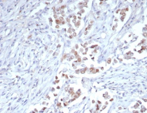 TRPS1 (Transcriptional repressor GATA binding 1) Antibody in Immunohistochemistry (Paraffin) (IHC (P))