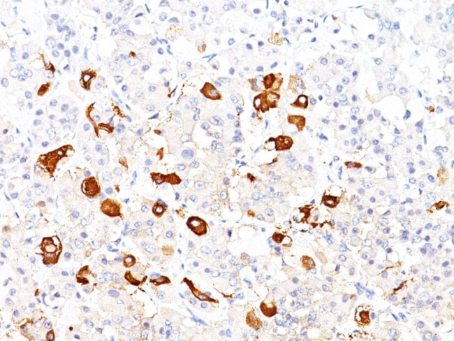 Thyroid Stimulating Hormone, beta (TSH beta) (Pituitary Marker) Antibody in Immunohistochemistry (Paraffin) (IHC (P))