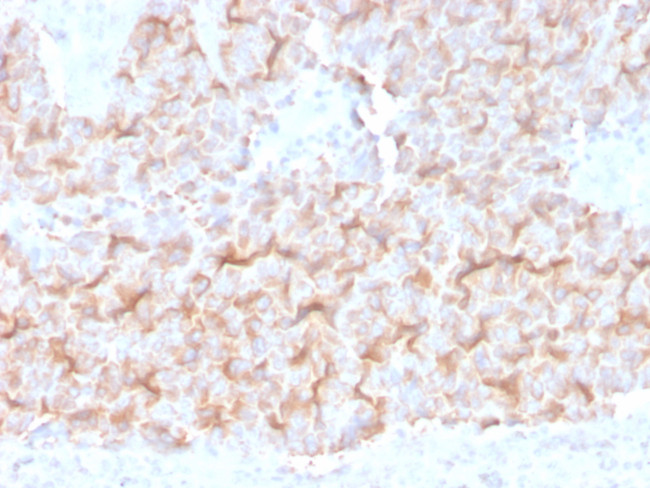 Tubulin-alpha (Microtubule Marker) Antibody in Immunohistochemistry (Paraffin) (IHC (P))