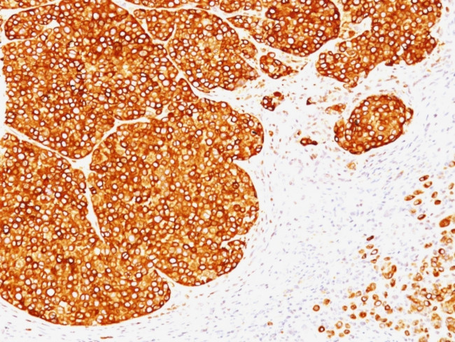 Tyrosinase (Melanoma Marker) Antibody in Immunohistochemistry (Paraffin) (IHC (P))