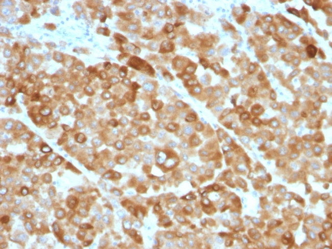 Tyrosinase (Melanoma Marker) Antibody in Immunohistochemistry (Paraffin) (IHC (P))
