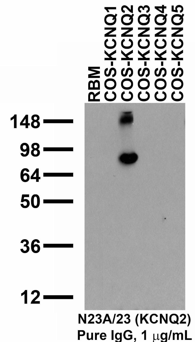 Kv7.2/KCNQ2 K+ channel Antibody in Western Blot (WB)