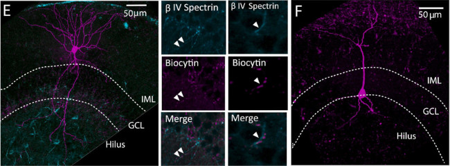 Beta4-Spectrin Antibody in Immunohistochemistry (Frozen) (IHC (F))