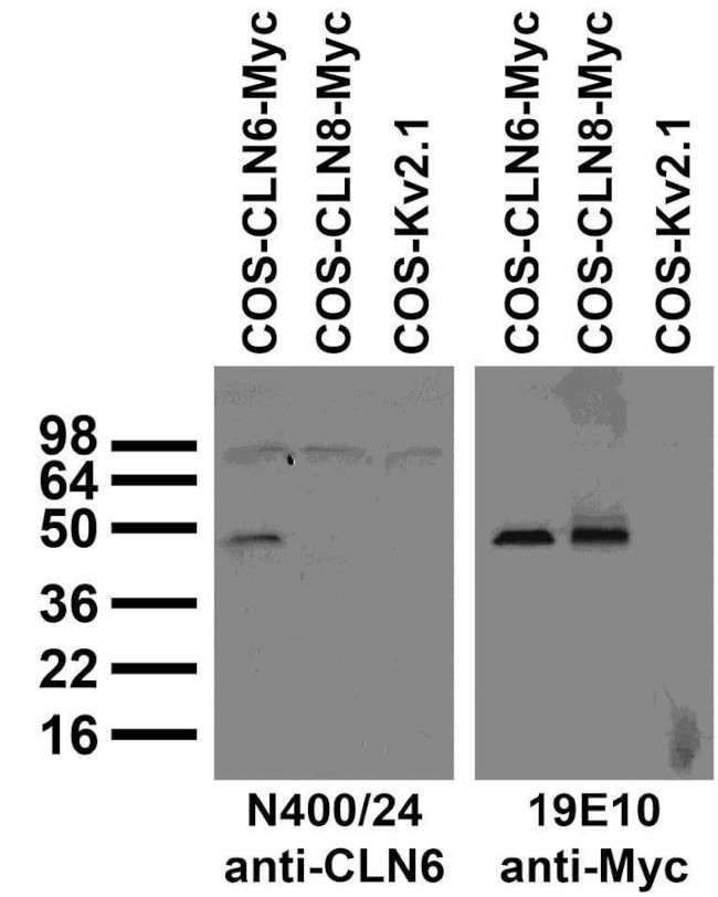 CLN6 Antibody in Western Blot (WB)